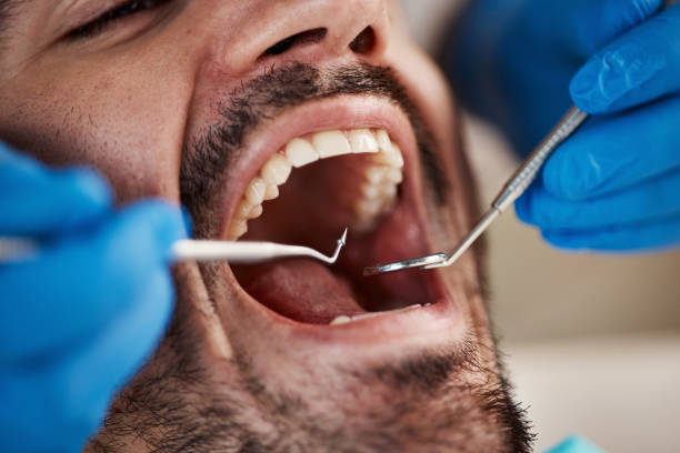 Best Wisdom Tooth Removal  in Flowood, MS